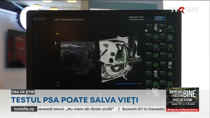 Tot mai mulți tineri, depistați cu cancer de prostată. Testul PSA poate salva vieți