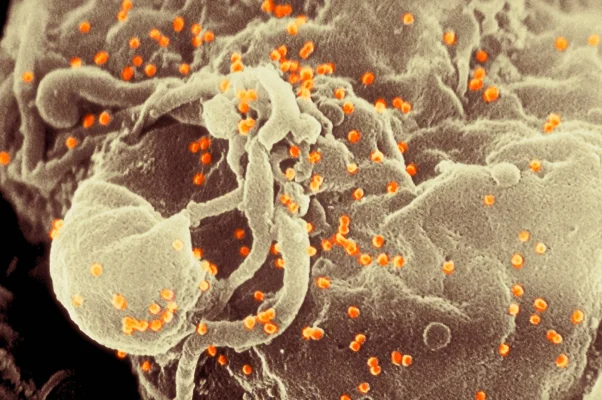 Progres major în lupta împotriva HIV. Tehnologia ARNm poate forța virusul latent să devină vizibil pentru sistemul imunitar