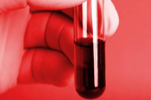 Descoperire uimitoare în medicină. A fost identificată o nouă grupă de sânge