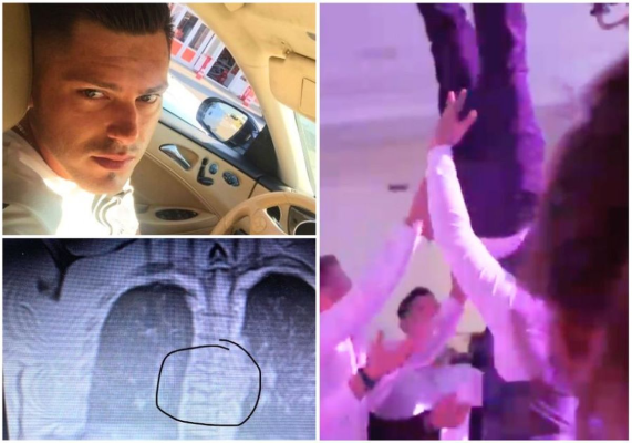 BIHOREANUL | Un mire i-a dat în judecată pe prietenii care l-au scăpat din brațe la nuntă. Ce daune a obținut în instanță