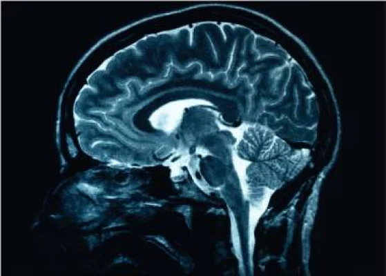 Statele Unite aprobă primul test de sânge pentru depistarea bolii Alzheimer