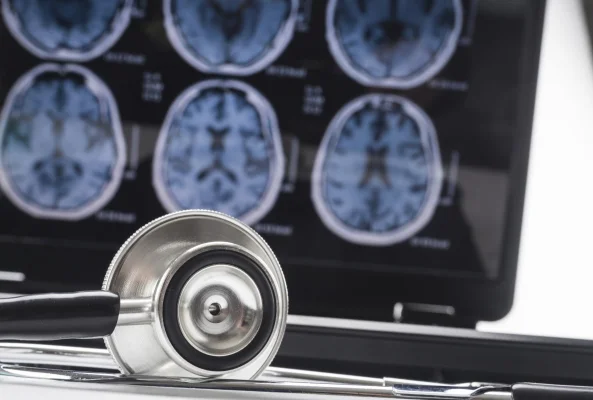 Alzheimer: ADN-ul dezvăluie cine este cel mai expus riscului și cum se va îmbolnăvi